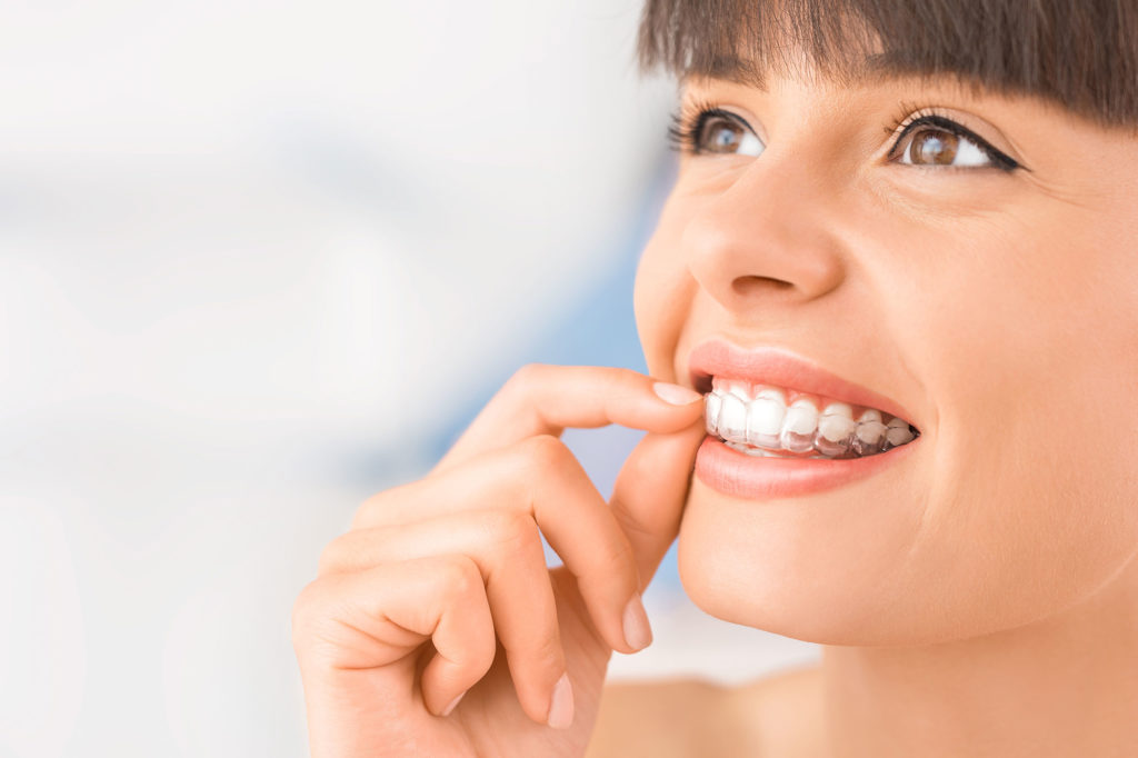 Invisalign® - North Royalton, OH