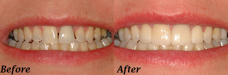 dental before and after - North Royalton, OH