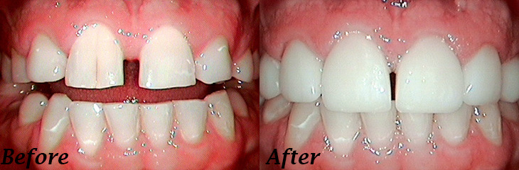 Dental Results - North Royalton, OH