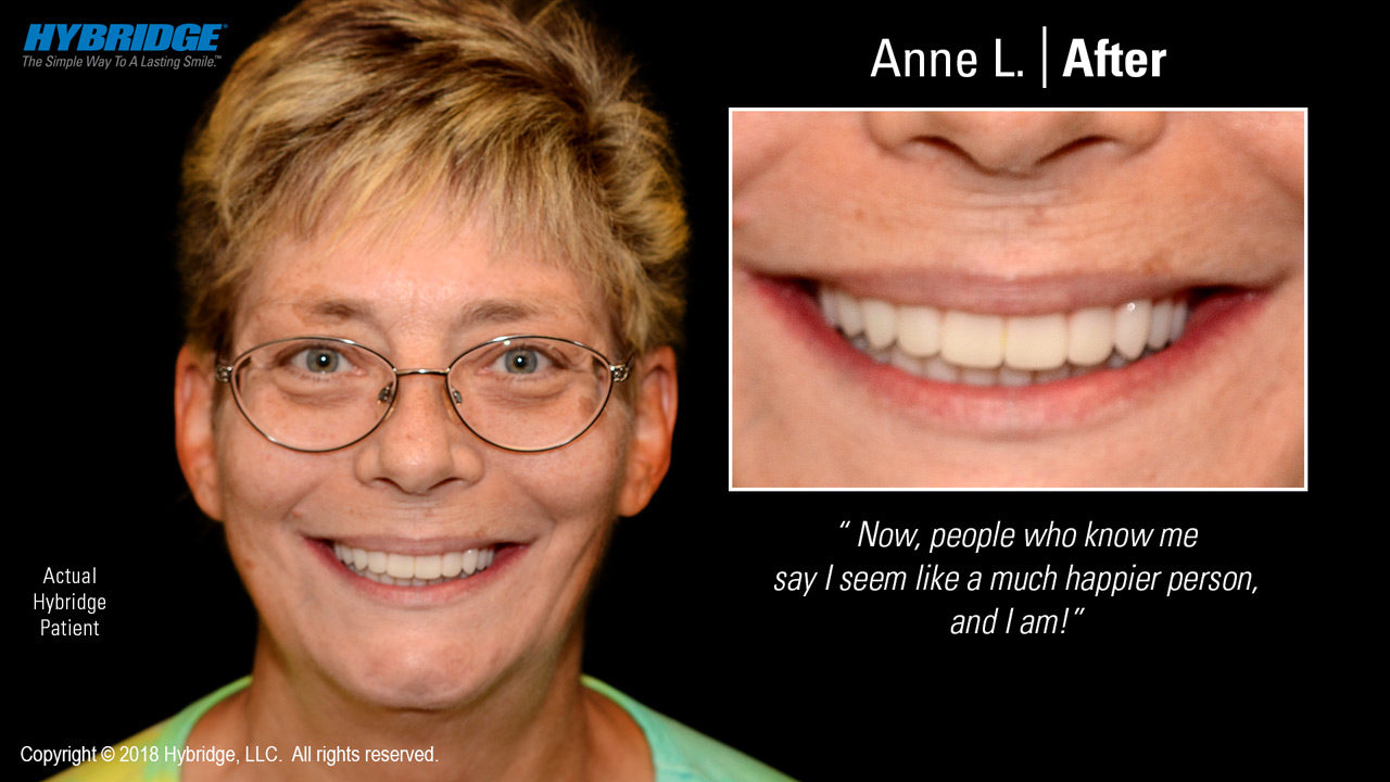 Anne L. After
